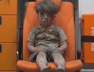 Haunting image of Syrian boy rescued from Aleppo rubble