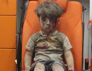 Brother of Omran, Syrian boy in haunting picture, dies of wounds