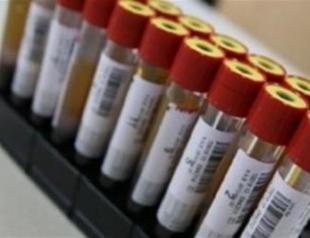 Turkish Stem Cell Bank makes first international transplant