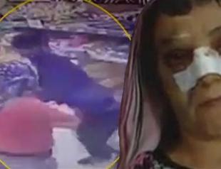 Turkish woman beaten for ‘not walking properly’ in Istanbul