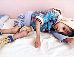 UN humanitarian chief says Yemen on verge of collapse