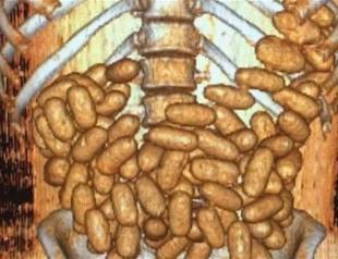 Istanbul police detain drug smugglers who swallowed 115 condoms