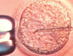 Dutch medical center probes suspected sperm mix-up