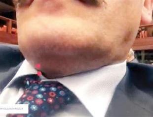 AKP MP revealed as holder of fake Twitter account with female name streaming charter talks on Periscope