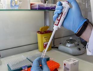 Turkish scientist develops quick DNA profiling kit