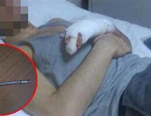 Child laborer in Turkey’s northwest hospitalized after taking radioactive material home