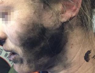Headphone batteries explode on flight to Australia