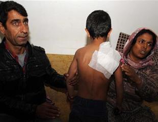 Fast food restaurant employee throws boiled water on seven-year-old boy in Istanbul