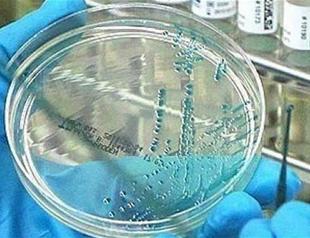 Antimicrobial chemicals pose risk to health: US scientists