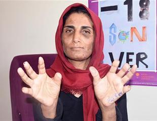 Turkish woman files criminal complaint against husband after 17 years of brutal torture