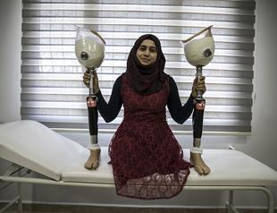 Syrian refugees get prosthetic limbs in Turkey