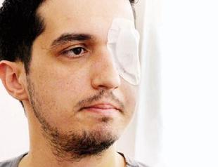Court orders Interior Ministry to pay over 1 million liras to man who lost eye during Gezi protests