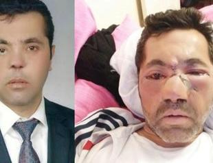 İzmir man receives 100,000 liras in compensation over infection in prison