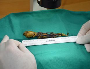 Tiny Atacama skeleton was girl with bone disease