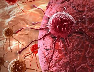 Cancer incidence rates in Turkey above world average, below Europe: Oncology professor