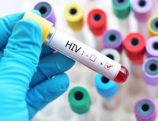 New research points to functional cure for HIV