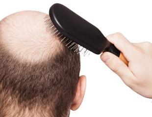 Calling husband ‘baldie’ is a marital flaw: Turkish court