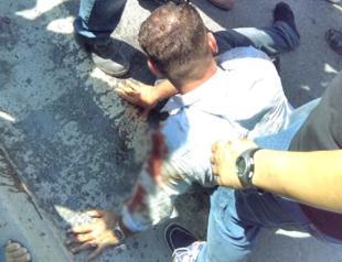 Saudi father escapes lynch in Istanbul over beating son