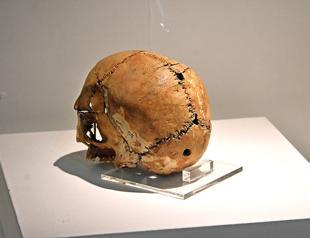 Ancient skull draws great interest at museum