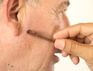 Ancient razorblade found in Domuztepe