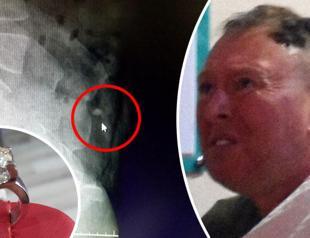 Irish man hospitalized in Turkey after swallowing stolen ring