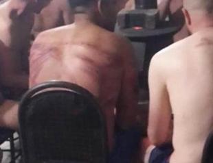 Turkish villagers warmly welcome migrants after Greek police beat them naked