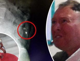 Irish man ‘swallowed diamond because he fell into trance’