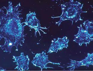 Israelis say they found cancer cure