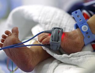 Turkeys fertility rate drops in 2018