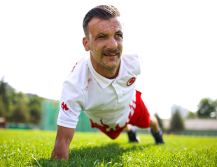 Landmine survivor doesn’t let losses hold him back