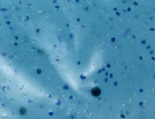 Microplastics in drinking water not a health risk for now: WHO