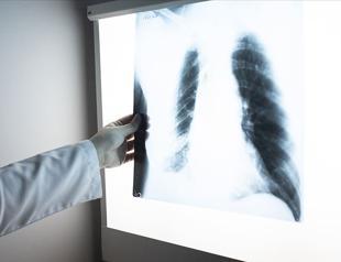 COPD getting more deadly in Turkey: Experts