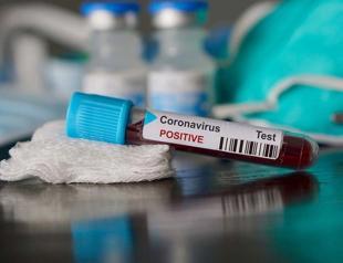 Turkey confirms second coronavirus case