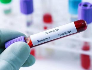 Turkey confirms second death from coronavirus, cases jump to 191