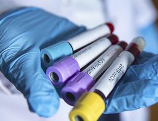 Coronavirus death toll rises to 21 in Turkey, 947 confirmed cases: Health Minister