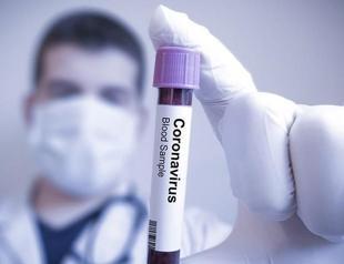 Turkeys coronavirus death toll up seven to 44, with 343 new cases