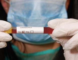 1,704 new cases confirmed in Turkey, death toll hits 108