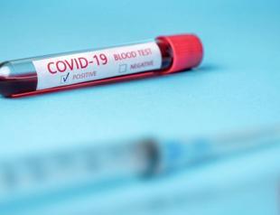 Ankara rebuffs claims of inaccurate coronavirus data as cases top 9,000