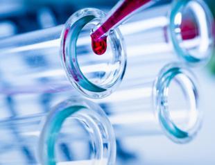 COVID-19 cases surpass 1.1 mln globally