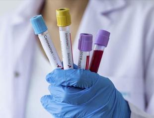 COVID-19 claims lives of 222 Turkish expats