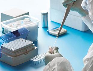 Turkish scientists develop COVID-19 testing kits