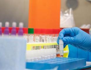 80 Turkish Cypriots die in UK due to coronavirus