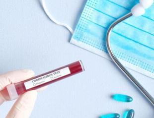 Turkey plans conducting nationwide massive virus tests to determine extent of spread