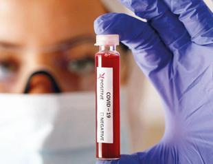 Our three weeks with the COVID-19 virus: Op-ed