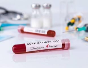 Three opposition lawmakers test positive for virus in Turkey