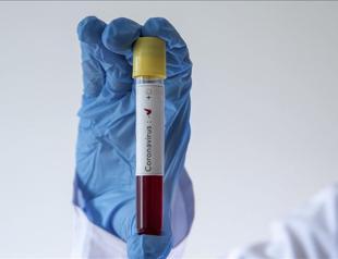 Turkish Cyprus reports no new COVID-19 cases for 41 days