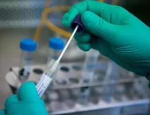 Turkey sets out new criteria for COVID-19 tests