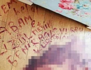 Woman reveals name of attacker with her own blood after getting shot