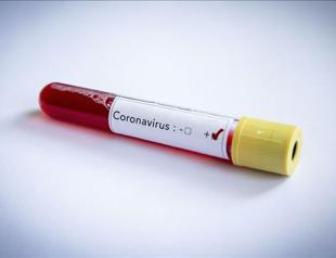 Ruling AKP lawmaker tests positive for coronavirus