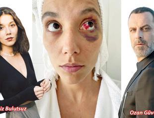 Turkish actor Ozan Güven accused of beating girlfriend